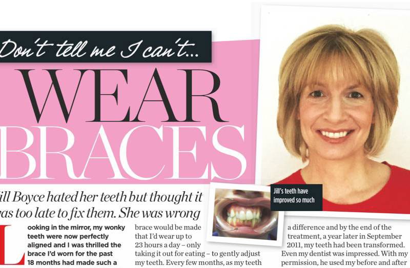 Jill Boyce braces article