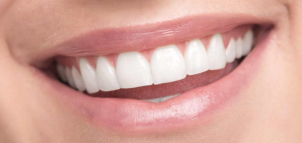 Teeth Whitening True or False?