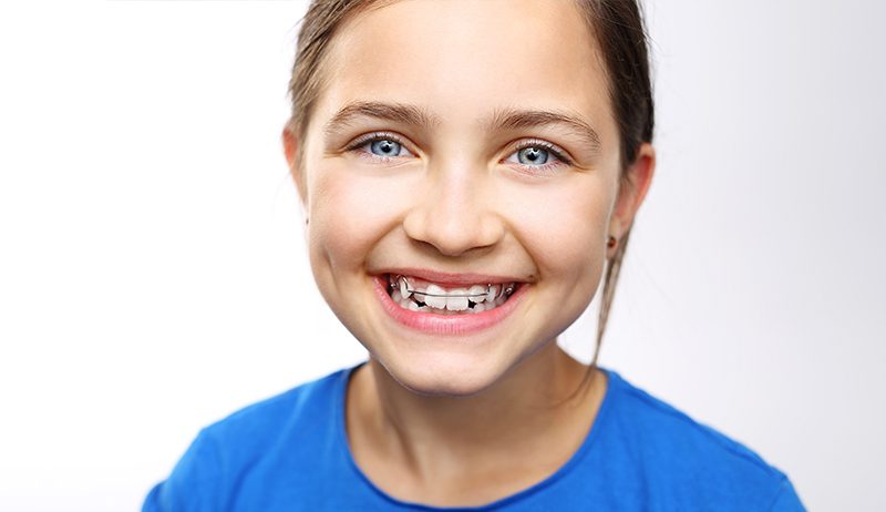 Girl in braces