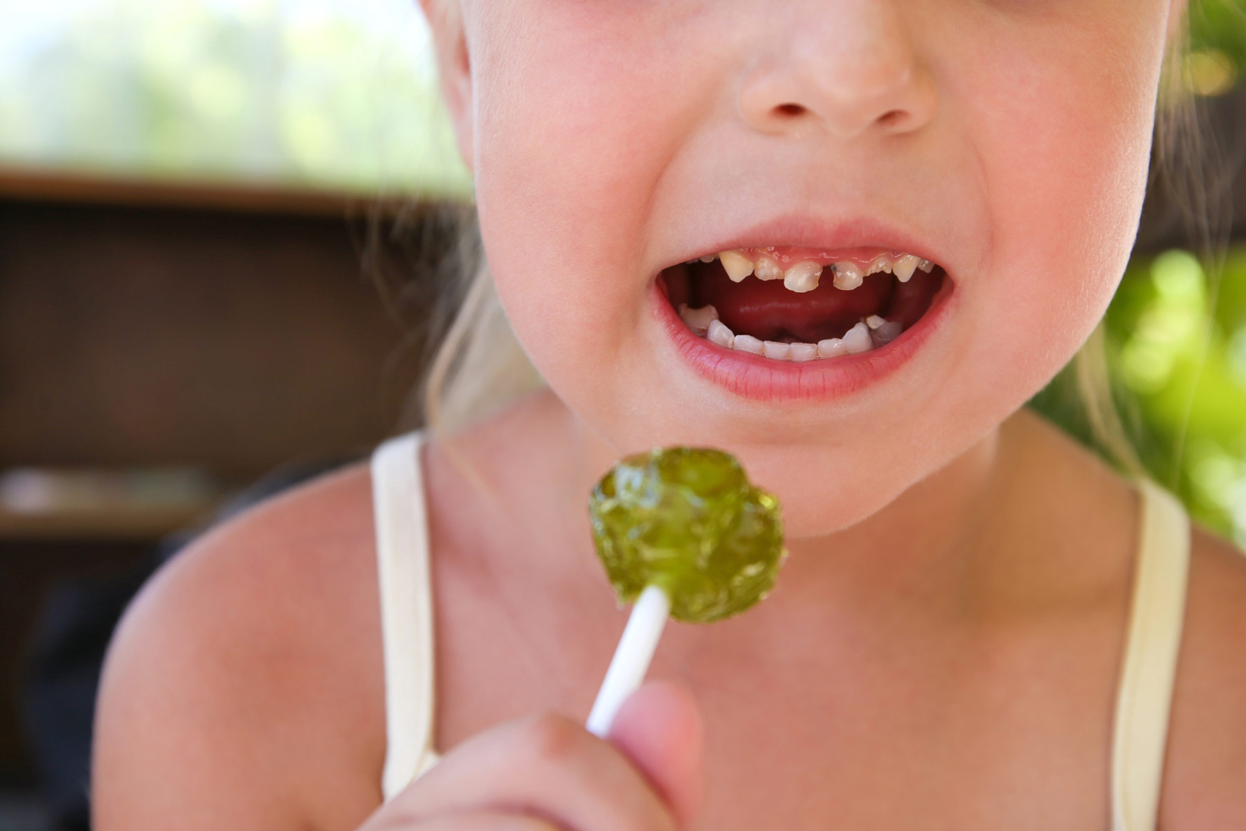 The truth about tooth decay